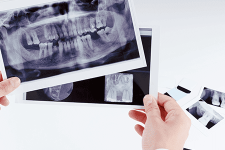 Policlínica Dental radiografía de boca