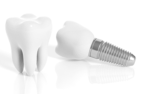 Policlínica Dental dientes en prótesis
