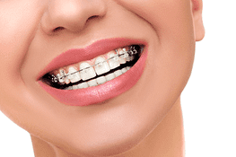 Policlínica Dental mujer con brackets